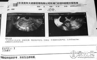 深圳宫外孕爆料新闻视频,生死时速，守护生命线  第3张